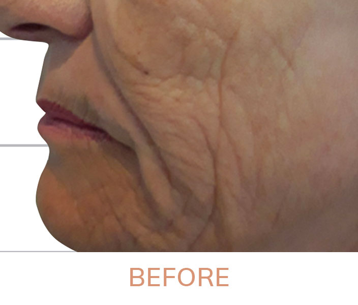 results-pictures-website_0020_Face-2-2