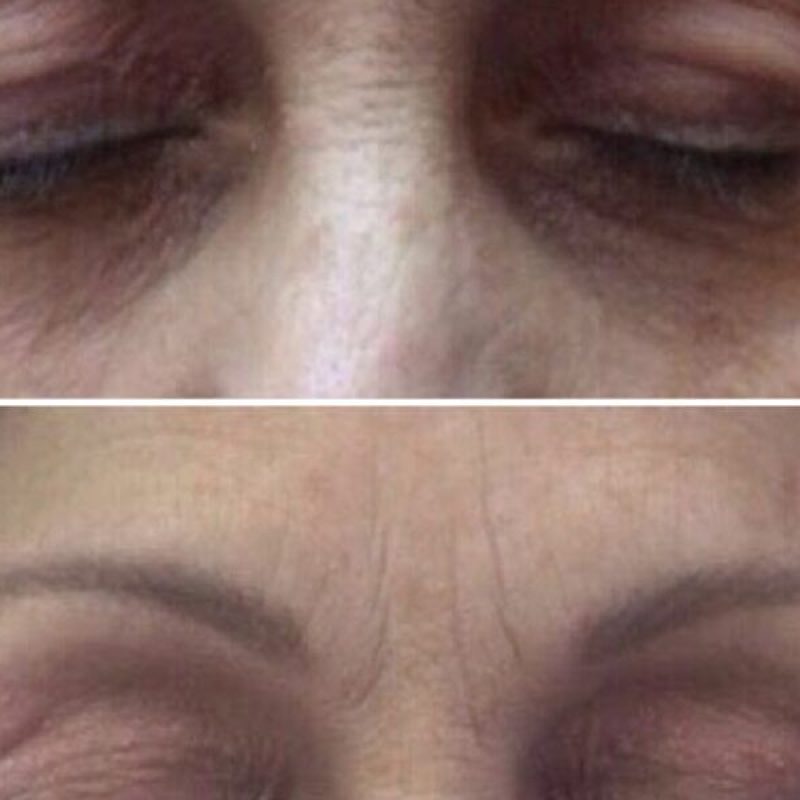 1e19684f5465aaf554ab9b4a32f7bbc4.plasmage2-3-900x600-1-pyklot5jngc761hutzypp7p25v7ji2oeiffc0yva68 (1)