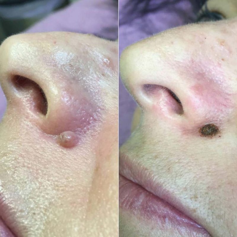 plasmage4-1021x1024-3-pykloysksgjx3p9nx2eh469tq6fqs9asj7c8wmmx4w