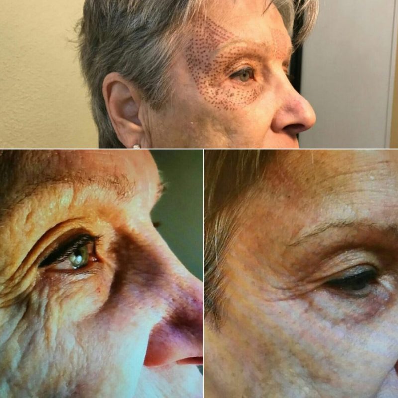 plasmage5-1024x907-3-1-pyklp1m3cyns2j5kglmctnk7ic1ufclzjlapcgiqm8